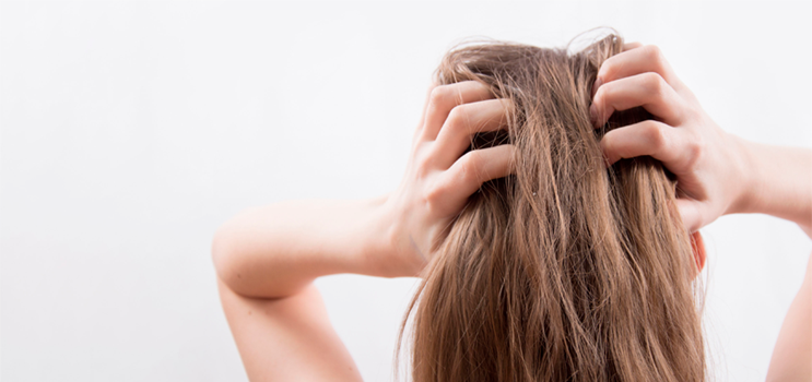 Sådan behandler du bedst skæl med skælshampoo