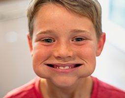 Sådan bevarer du et smukt smil hele livet